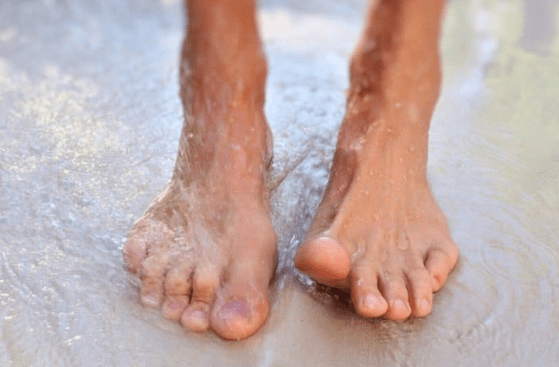 Las razones para el desarrollo de la micosis