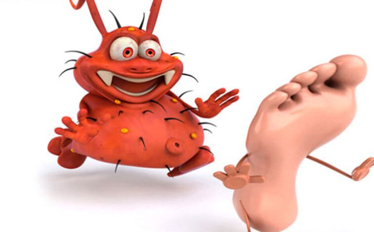 Clasificación de la micosis de las piernas