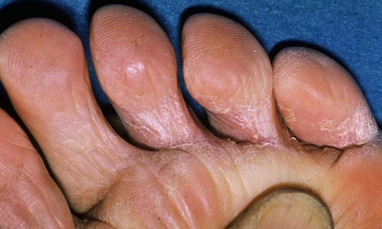 Varios tipos de piernas de las piernas