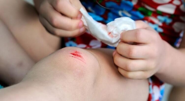 ¿Cómo se puede contraer una infección por un hongo